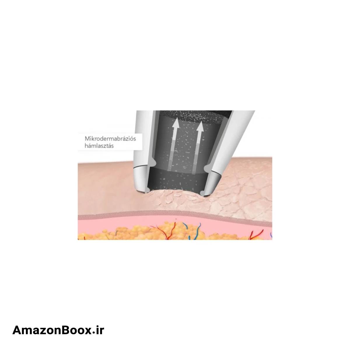 میکرودرم اسکینرا مدل IN4501